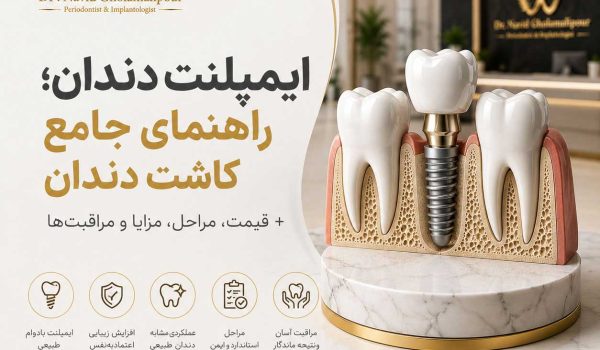 ایمپلنت-دندان