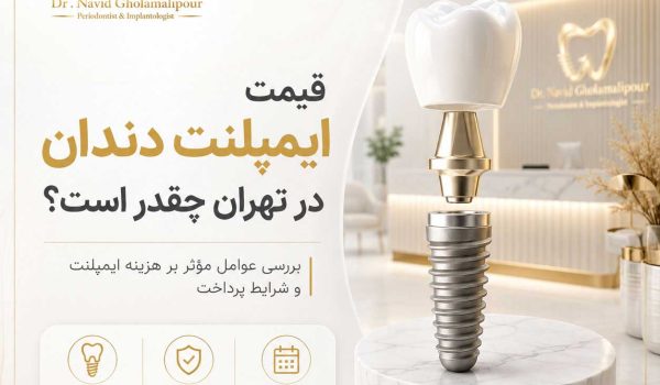 قیمت-ایمپلنت-دندان