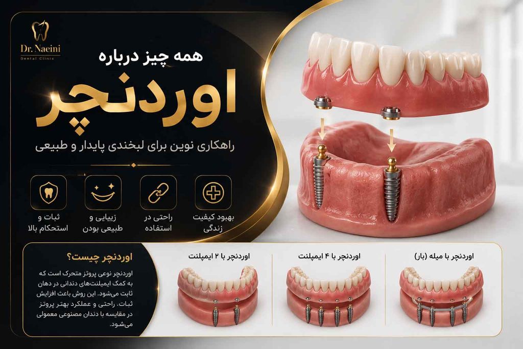 اوردنچر