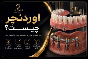اوردنچر چیست