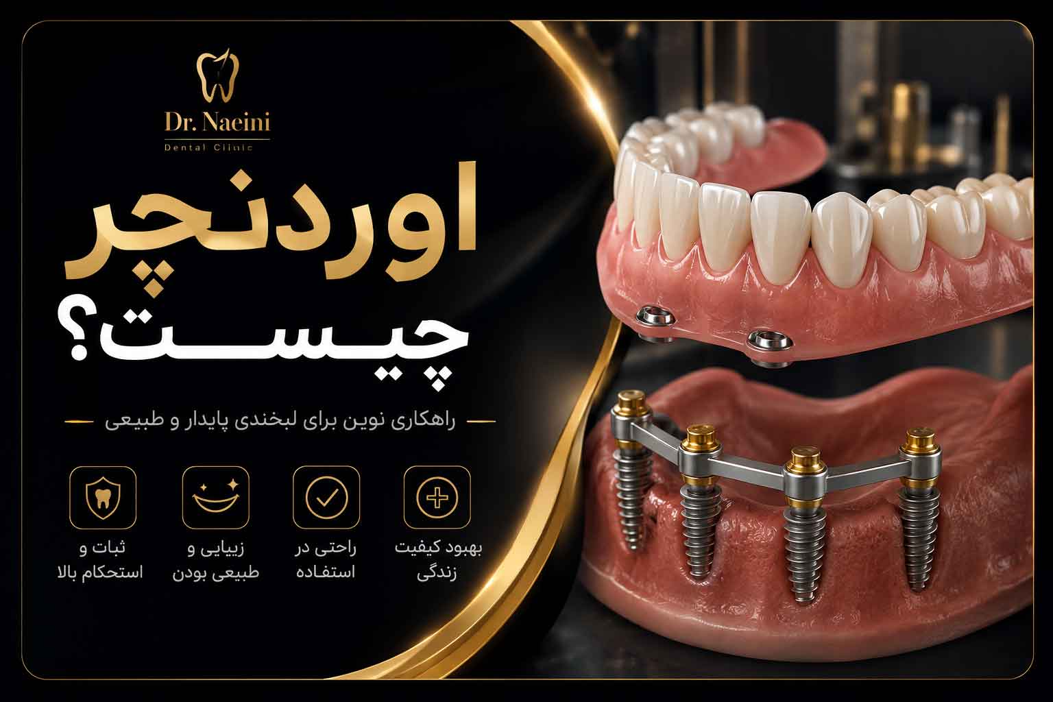 اوردنچر چیست