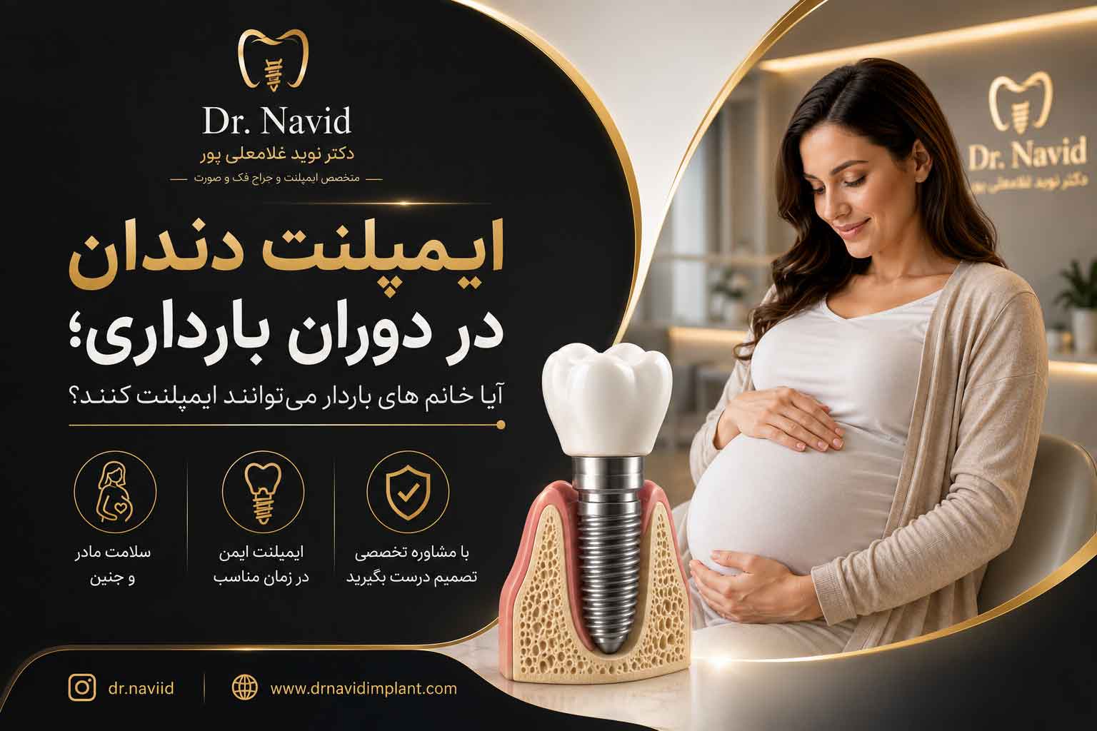 ایمپلنت دندان در دوران بارداری