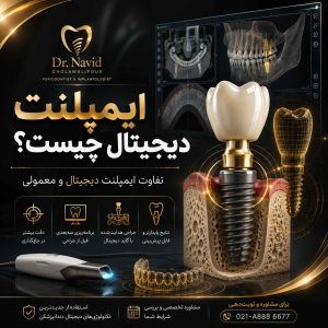ایمپلنت دیجیتال