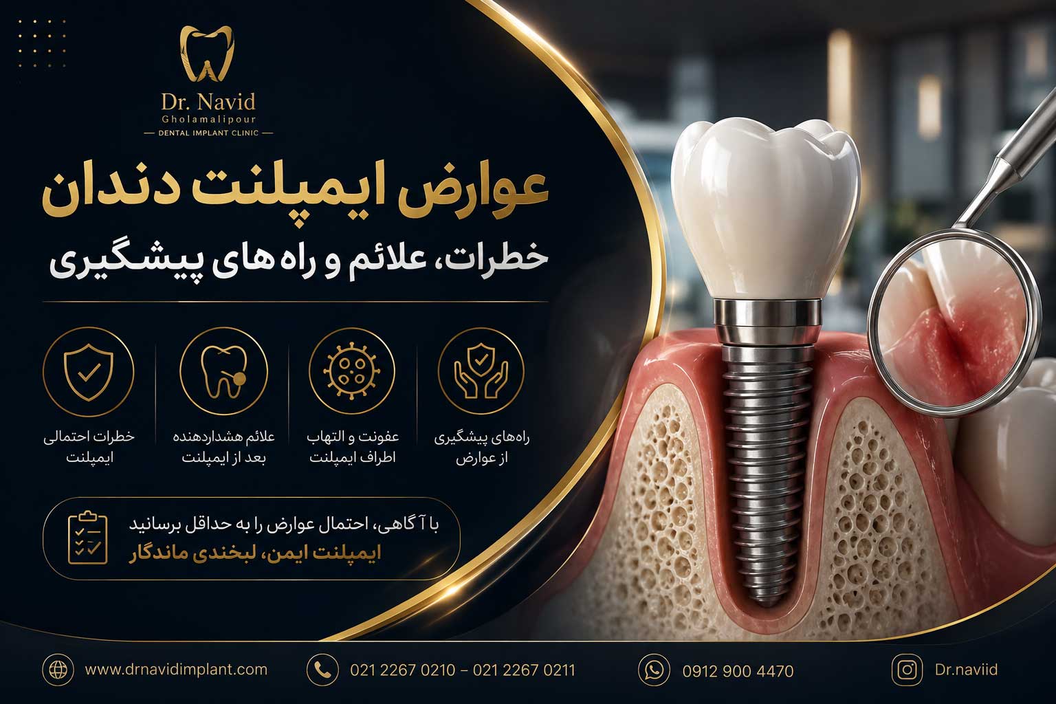 عوارض ایمپلنت دندان و راه های پیشگیری