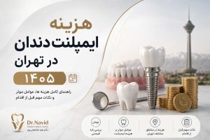 قیمت ایمپلنت