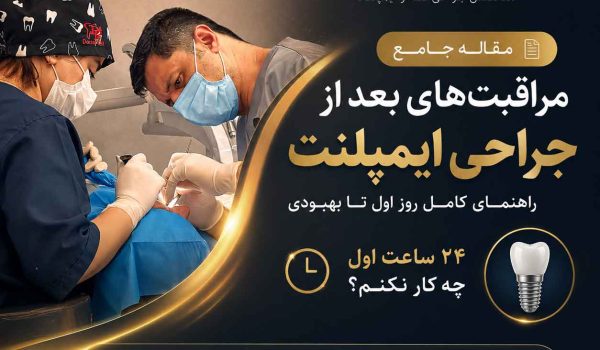 مراقبت های بعد از ایمپلنت