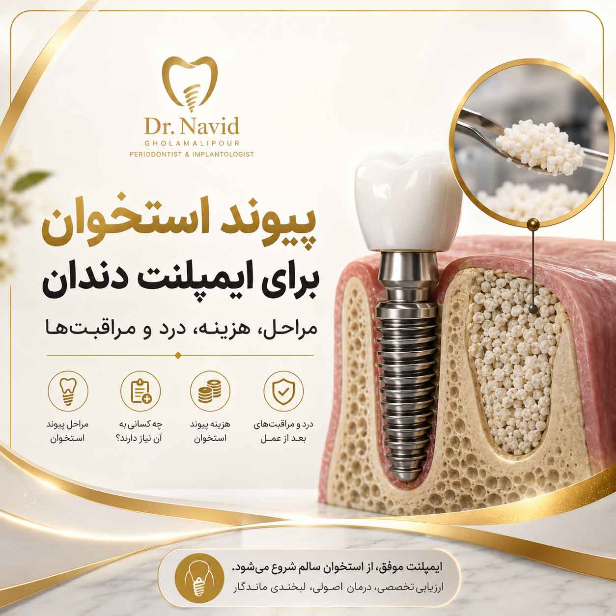 پیوند استخوان برای ایمپلنت دندان
